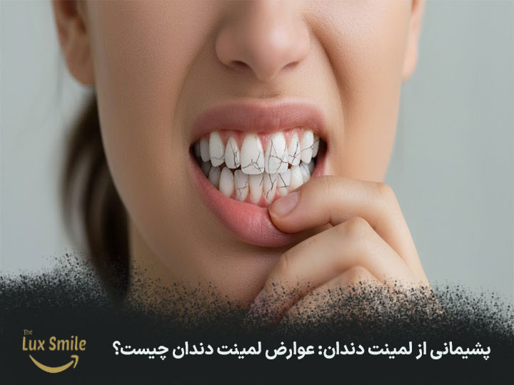 عوارض لمینت دندان چیست؟